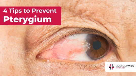 Prevent pterygium article header